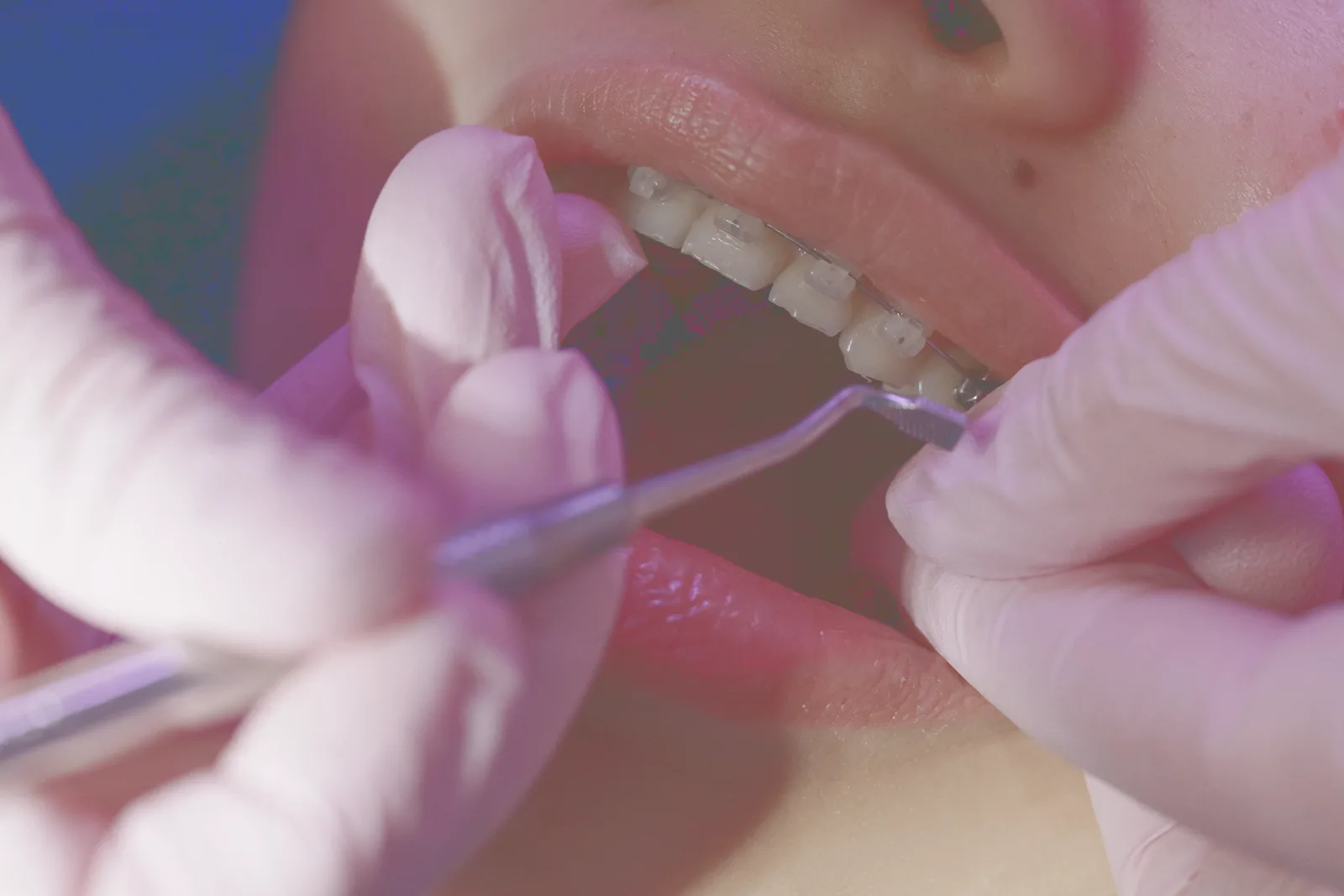 An orthodontist adjusting fixed appliances during a routine visit.